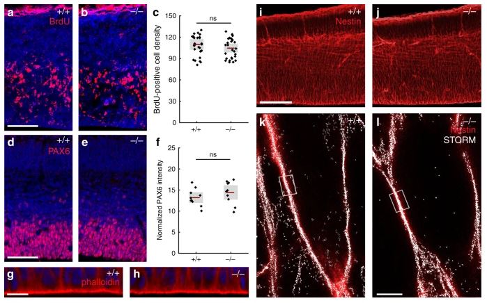 New study published by KOKI researchers: ’ABHD4-dependent developmental anoikis safeguards the embryonic brain’